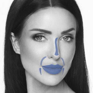 Infini Premium Filler L + LIDOCAINE - Image 2