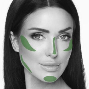 Infini Premium Filler XL + LIDOCAINE - Image 2